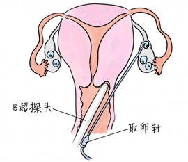 幼儿学画画，武汉捐卵宝宝学画画，学画画的好处，如何学画画