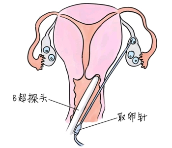 幼儿学画画，武汉捐卵宝宝学画画，学画画的好处，如何学画画